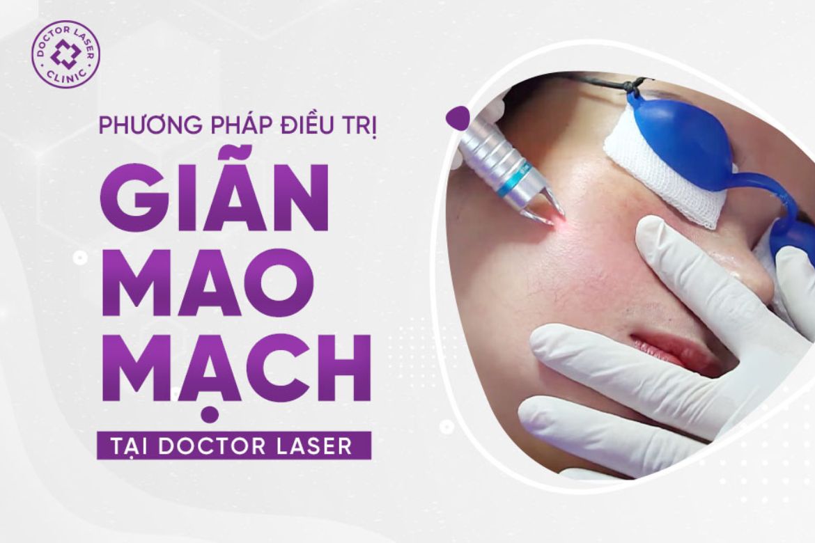 Trị giãn mao mạch bao nhiêu tiền? Giãn mao mạch có nguy hiểm không?